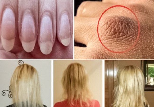 Si vous avez la peau sèche, les ongles cassants ou une chute de cheveux